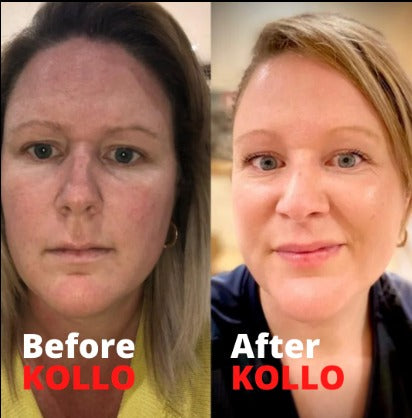 Recupera tu Juventud Desde Adentro con Multi Colágeno Peptides Plus