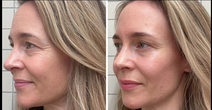 Recupera tu Juventud Desde Adentro con Multi Colágeno Peptides Plus