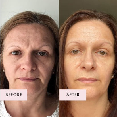 Recupera tu Juventud Desde Adentro con Multi Colágeno Peptides Plus